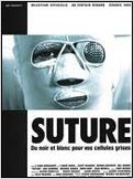 Suture
