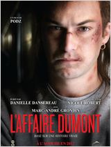 L'affaire Dumont